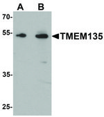 Anti-TMEM135 antibody produced in rabbit affinity isolated antibody, buffered aqueous solution