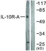 Anti-IL-10R α antibody produced in rabbit affinity isolated antibody