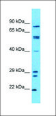 Anti-ZFP42 antibody produced in rabbit affinity isolated antibody