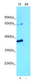 Anti-NOX5 (C-terminal) antibody produced in rabbit affinity isolated antibody