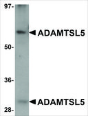Anti-ADAMTSL5 antibody produced in chicken affinity isolated antibody, buffered aqueous solution
