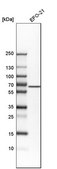 Anti-ACVRL1 antibody produced in rabbit Prestige Antibodies® Powered by Atlas Antibodies, affinity isolated antibody, buffered aqueous glycerol solution