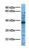 Anti-HCAR2 antibody produced in rabbit affinity isolated antibody