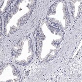 Anti-NKAIN4 antibody produced in rabbit Prestige Antibodies® Powered by Atlas Antibodies, affinity isolated antibody, buffered aqueous glycerol solution