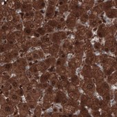 Monoclonal Anti-PGM1 antibody produced in mouse Prestige Antibodies® Powered by Atlas Antibodies, clone CL3299, purified immunoglobulin, buffered aqueous glycerol solution