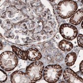 Monoclonal Anti-CTNNB1 antibody produced in mouse Prestige Antibodies® Powered by Atlas Antibodies, clone CL3689, purified immunoglobulin, buffered aqueous glycerol solution