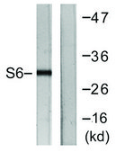 Anti-S6 Ribosomal Protein, C-Terminal antibody produced in rabbit affinity isolated antibody