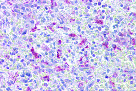 Anti-EZH1, (N-terminal) antibody produced in rabbit affinity isolated antibody