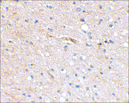 Anti-SCRAPPER (ab2) antibody produced in rabbit affinity isolated antibody, buffered aqueous solution