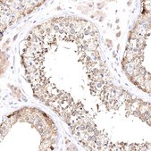 Anti-VPS45 antibody produced in rabbit Prestige Antibodies® Powered by Atlas Antibodies, affinity isolated antibody, buffered aqueous glycerol solution