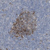 Anti-UBAP2 antibody produced in rabbit Prestige Antibodies® Powered by Atlas Antibodies, affinity isolated antibody, buffered aqueous glycerol solution