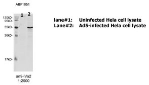 Anti-Adenovirus 5 Packaging protein IVa2