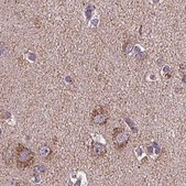 Anti-SUCLA2 antibody produced in rabbit Prestige Antibodies® Powered by Atlas Antibodies, affinity isolated antibody