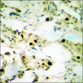 Anti-phospho-NPM (pThr199) antibody produced in rabbit affinity isolated antibody
