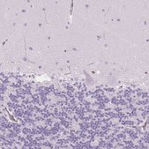 Anti-TMEM45A antibody produced in rabbit Prestige Antibodies® Powered by Atlas Antibodies, affinity isolated antibody, buffered aqueous glycerol solution