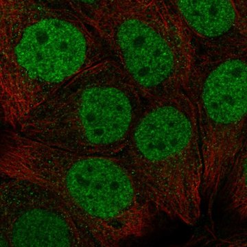 Anti-Cbx6 Antibody Produced In Rabbit Prestige Antibodies&#174; Powered by Atlas Antibodies, affinity isolated antibody, buffered aqueous glycerol solution