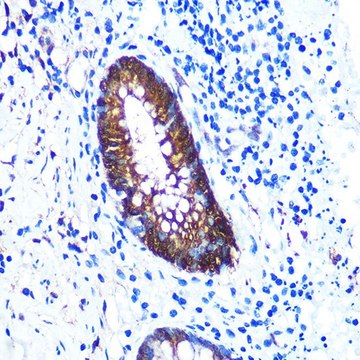 Anti-Galectin 3/LGALS3 antibody produced in rabbit