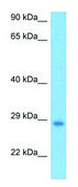Anti-Pcsk1n (N-terminal) antibody produced in rabbit affinity isolated antibody