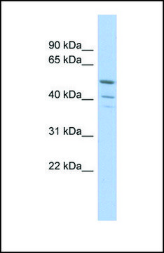 Anti-TRIM50 antibody produced in rabbit affinity isolated antibody