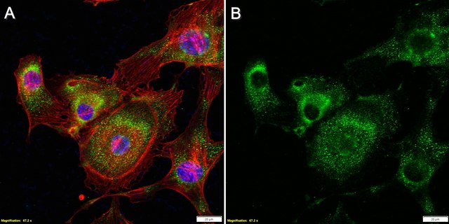 Anti-FLT4 Antibody, clone 2F4 ZooMAb&#174; Rabbit Monoclonal recombinant, expressed in HEK 293 cells