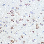 Anti-GluR2/GRIA2 antibody produced in rabbit
