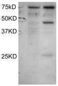 Anti-DYX1C1 (Isoform A) antibody produced in goat affinity isolated antibody, buffered aqueous solution