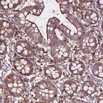 Anti-PATJ antibody produced in rabbit Prestige Antibodies&#174; Powered by Atlas Antibodies, affinity isolated antibody, buffered aqueous glycerol solution