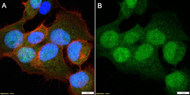 Anti-SOX4 Antibody, clone 2K15 ZooMAb&#174; Rabbit Monoclonal recombinant, expressed in HEK 293 cells