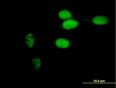 Anti-TIMELESS antibody produced in mouse purified immunoglobulin, buffered aqueous solution