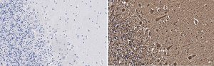 Anti-Aldolase C Antibody, clone 3B18, ZooMAb® Rabbit Monoclonal recombinant, expressed in HEK 293 cells