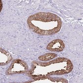 Anti-CCNO antibody produced in rabbit Prestige Antibodies® Powered by Atlas Antibodies, affinity isolated antibody, buffered aqueous glycerol solution