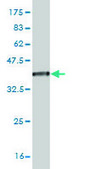 Monoclonal Anti-ZFP36L1 antibody produced in mouse clone 1A3, purified immunoglobulin, buffered aqueous solution
