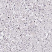 Anti-AKAP8L antibody produced in rabbit Prestige Antibodies® Powered by Atlas Antibodies, affinity isolated antibody, buffered aqueous glycerol solution
