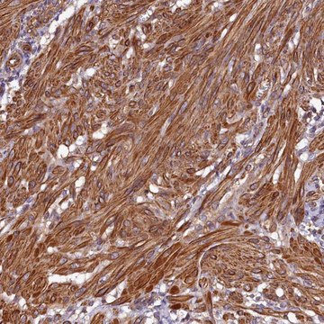 Anti-CCDC102B antibody produced in rabbit Prestige Antibodies&#174; Powered by Atlas Antibodies, affinity isolated antibody, buffered aqueous glycerol solution