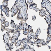 Anti-VRK1 antibody produced in rabbit Prestige Antibodies® Powered by Atlas Antibodies, affinity isolated antibody, buffered aqueous glycerol solution