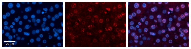 Anti-RUNX1T1 antibody produced in rabbit affinity isolated antibody