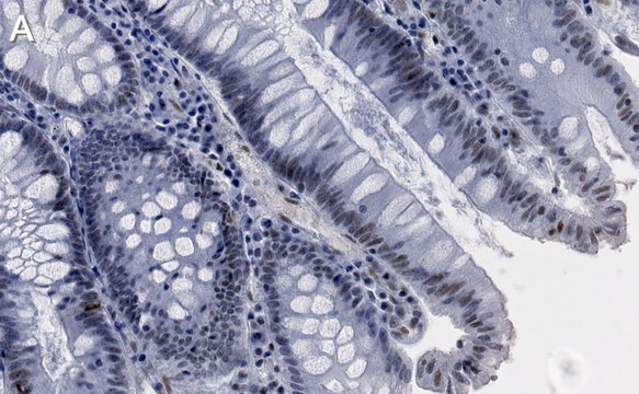 Anti-p-DNA-PKcs-Ser2056 Antibody, clone 1K3 ZooMAb&#174; Rabbit Monoclonal recombinant, expressed in HEK 293 cells