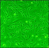 Rat Cardiac Fibroblasts: RCF, adult