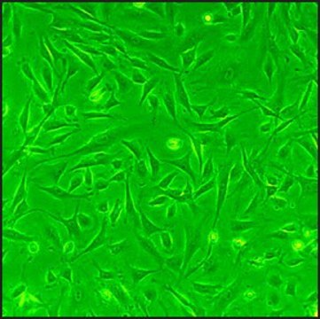 Rat Cardiac Fibroblasts: RCF, adult