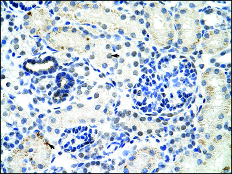 Anti-DDX17 antibody produced in rabbit IgG fraction of antiserum