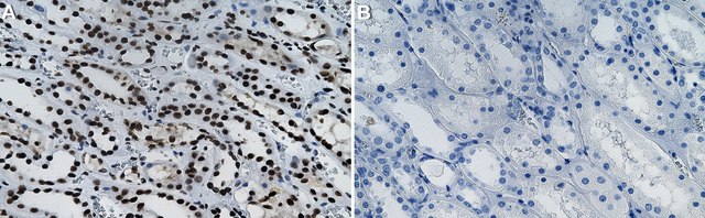 Anti-SMAD7 Antibody, clone 2D15 ZooMAb&#174; Rabbit Monoclonal recombinant, expressed in HEK 293 cells