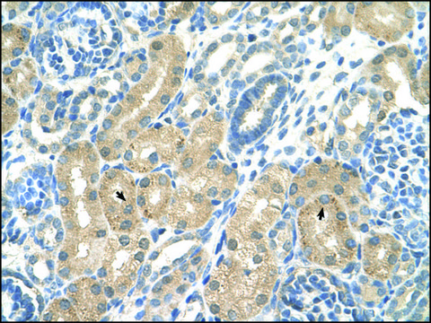 Anti-KHK antibody produced in rabbit affinity isolated antibody