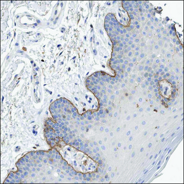 Anti-LAMC2 antibody produced in rabbit Prestige Antibodies&#174; Powered by Atlas Antibodies, affinity isolated antibody, buffered aqueous glycerol solution