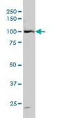 Monoclonal Anti-DDX54 antibody produced in mouse clone 2H6, purified immunoglobulin, buffered aqueous solution