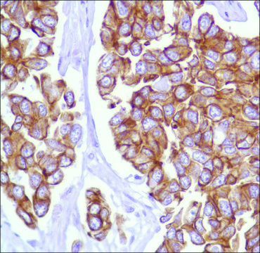 Anti-Keratin 18 antibody, Rabbit monoclonal clone SP69, recombinant, expressed in proprietary host, affinity isolated antibody