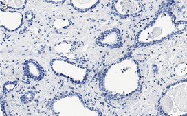 Anti-phospho-mTOR-(Ser2448) Antibody, clone 1C22 ZooMAb® Rabbit Monoclonal recombinant, expressed in HEK 293 cells