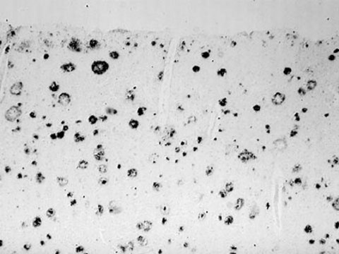 Anti-Amyloid Antibody, &#946; 37-42, a&#946; serum, Chemicon&#174;