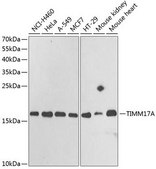 Anti-TIMM17A antibody produced in rabbit