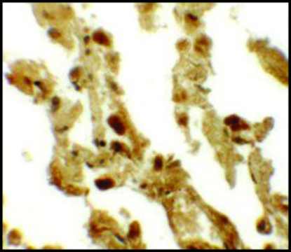 Anti-ESRP2 antibody produced in rabbit affinity isolated antibody