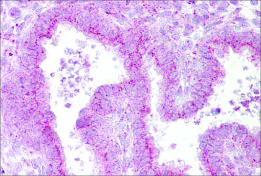 Anti-GOLGB1 antibody produced in rabbit affinity isolated antibody